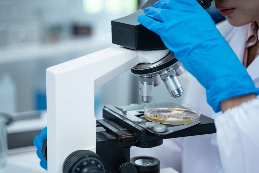 Laboratory testing of indoor air samples to identify airborne mold spores and evaluate residential mold contamination